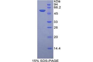 SDS-PAGE analysis of Human LAMP1 Protein.