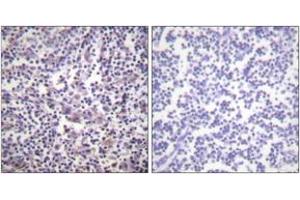 Immunohistochemistry analysis of paraffin-embedded human lymph node tissue, using B-RAF (Ab-601) Antibody. (SNRPE anticorps  (AA 576-625))