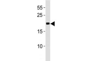 MGMT antibody western blot analysis in Jurkat lysate. (MGMT anticorps  (AA 156-182))