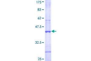 Image no. 1 for Complement Component C4b (C4b) (AA 774-873) protein (GST tag) (ABIN1347540)