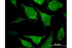 Immunofluorescence of monoclonal antibody to DECR2 on HeLa cell.