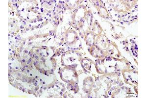 Formalin-fixed and paraffin embedded mouse kidney labeled with Anti-CUEDC2/CUE domain containing 2 Polyclonal Antibody, Unconjugated  at 1:300 followed by conjugation to the secondary antibody and DAB staining