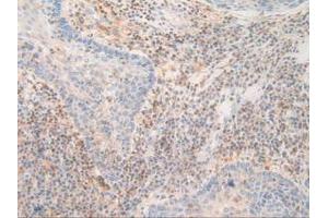 Figure. (PDXK anticorps  (AA 29-253))