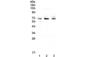Western blot testing of human 1) A549, 2) SGC-7901 and 3) U-2 OS cell lysate with Bestrophin 1 antibody at 0.