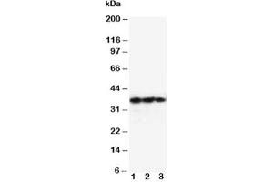 Western blot testing of EPO antibody and Lane 1:  Recombinant human protein 10ng;  2: 5ng;  3: 2.