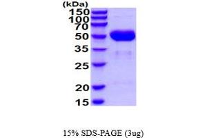 SDS-PAGE (SDS) image for Cathepsin A (CTSA) (AA 24-474) protein (His tag) (ABIN5854541) (CTSA Protein (AA 24-474) (His tag))