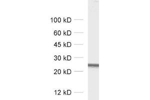 dilution: 1 : 1000, sample: rat brain homogenate (RAB5 anticorps  (AA 182-196))