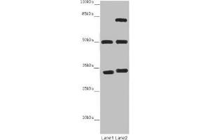 Western blot All lanes: TUBA1B antibody at 12 μg/mL Lane 1: Mouse brain tissue Lane 2: Mouse liver tissue Secondary Goat polyclonal to rabbit IgG at 1/10000 dilution Predicted band size: 51, 38 kDa Observed band size: 51, 34, 75 kDa (TUBA1B anticorps  (AA 29-310))