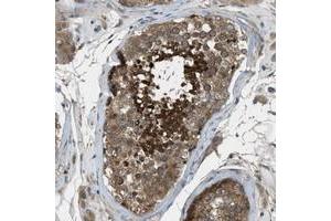 Immunohistochemical staining of human testis with VEZT polyclonal antibody  shows strong positivity in cells of ductus seminiferus.