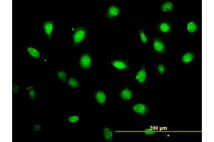 Immunofluorescence of monoclonal antibody to ZFYVE19 on HeLa cell. (ZFYVE19 anticorps  (AA 1-396))