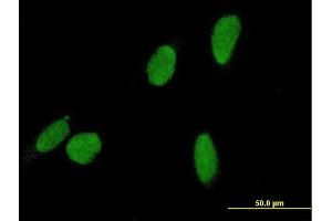 Immunofluorescence of purified MaxPab antibody to DCC1 on HeLa cell. (DSCC1 anticorps  (AA 1-393))