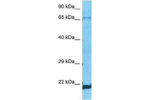 Host:  Rabbit  Target Name:  ZNF8  Sample Type:  A549 Whole Cell lysates  Antibody Dilution:  1. (ZNF8 anticorps  (C-Term))