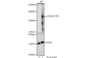 Western blot analysis of extracts of Raji cells, using Phospho-PLC gamma 2 (PLCG2)-Y759 pAb (ABIN7269341) at 1:2000 dilution or PLC gamma 2 (PLCG2) antibody (ABIN3023144, ABIN3023145, ABIN3023146 and ABIN6219411). (Phospholipase C gamma 2 anticorps  (pTyr759))