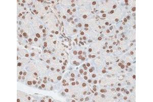 Immunohistochemistry of paraffin-embedded Rat pancreas using ZNF177 Polyclonal Antibody at dilution of 1:100 (40x lens). (ZNF177 anticorps)