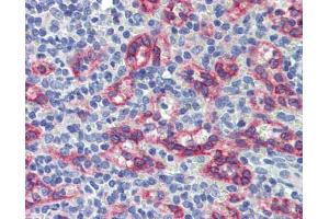 Human spleen; Anti-ZNF71 antibody IHC staining of human spleen. (ZNF71 anticorps)