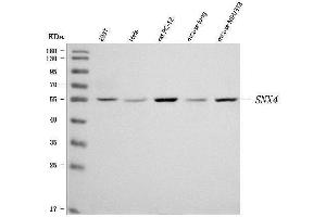 Western blot analysis of SNX4 using anti-SNX4 antibody (ABIN7599406).