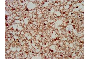 IHC image of ABIN7169333 diluted at 1:200 and staining in paraffin-embedded human brain tissue performed on a Leica BondTM system.
