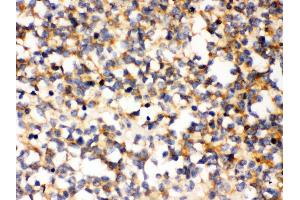 Anti- PAK5 Picoband antibody, IHC(P) IHC(P): Human Glioma Tissue (PAK7 anticorps  (N-Term))
