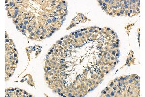 ABIN6263024 and ABIN6278127 at 1/100 staining Mouse testis tissue by IHC-P. (Lactoferrin anticorps  (C-Term))
