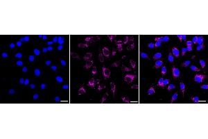 anti-Keratin 17 (KRT17) antibody