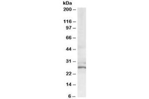 Western blot testing of HeLa lysate with TIP30 antibody at 0. (HIV-1 Tat Interactive Protein 2, 30kDa (HTATIP2) anticorps)