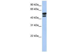 Vimentin antibody used at 1 ug/ml to detect target protein. (Vimentin anticorps  (N-Term))