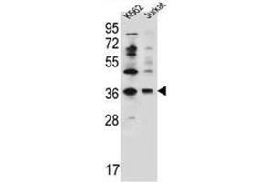 Western blot analysis of PPP1R3G Antibody (C-term) Cat. (PPP1R3G anticorps  (C-Term))
