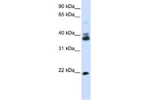 WB Suggested Anti-SYP Antibody Titration:  0. (Synaptophysin anticorps  (N-Term))