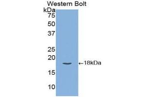 Western Blotting (WB) image for anti-Tissue Factor Pathway Inhibitor (Lipoprotein-Associated Coagulation Inhibitor) (TFPI) (AA 29-210) antibody (ABIN1172818) (TFPI anticorps  (AA 29-210))