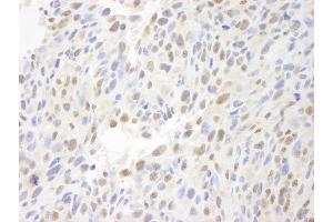 Immunohistochemistry (IHC) image for anti-Chemokine (C-C Motif) Ligand 2 (CCL2) (AA 25-100) antibody (ABIN7448645) (CCL2 anticorps  (AA 25-100))