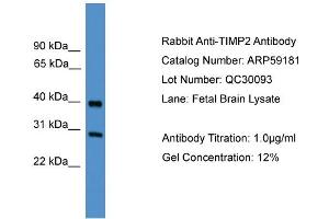 WB Suggested Anti-TIMP2  Antibody Titration: 0. (TIMP2 anticorps  (Middle Region))