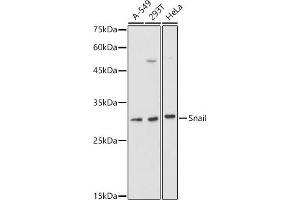 Western blot analysis of extracts of various cell lines, using Snail antibody (ABIN1682836, ABIN3019402, ABIN3019403, ABIN3019404 and ABIN6220883) at 1:1000 dilution. (SNAIL anticorps  (AA 1-100))