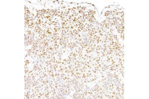 Immunohistochemistry (IHC) image for anti-Fused in Sarcoma (FUS) (AA 400-450) antibody (ABIN7453433)