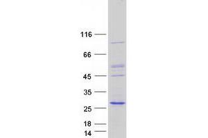 Validation with Western Blot