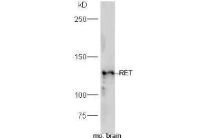 Mouse brain lysates probed with Rabbit Anti-RET Polyclonal Antibody, Unconjugated (ABIN2559573) at 1:300 in 4˚C. (Ret Proto-Oncogene anticorps  (AA 501-600))