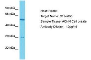 Image no. 1 for anti-Chromosome 19 Open Reading Frame 66 (C19ORF66) (AA 35-84) antibody (ABIN6750629) (C19ORF66 anticorps  (AA 35-84))