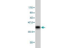 Western Blot detection against Immunogen (36. (GRK6 anticorps  (AA 71-170))