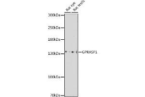 Western blot analysis of extracts of various cell lines, using GPR antibody (ABIN7267314) at 1:1000 dilution. (GPRASP1 anticorps  (AA 200-500))