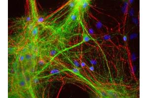 Mixed neuron and glia cultures stained with ABIN1580433 (green), and RPCA- NF-H rabbit antibody to neurofilament NF-H (red) and DNA (blue). (MAP2 anticorps)