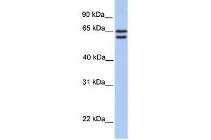 CDYL2 antibody used at 1 ug/ml to detect target protein. (CDYL2 anticorps  (N-Term))