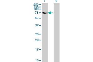 anti-E74-Like Factor 2 (Ets Domain Transcription Factor) (ELF2) (AA 1-581) antibody