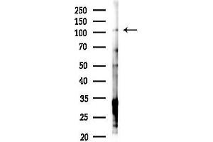 Western blot analysis of lysates from Hela cells(starvation,24h treatment), using ZNF295 Antibody at 1/1000 dilution.
