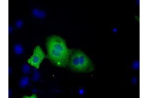 Image no. 11 for anti-Transforming, Acidic Coiled-Coil Containing Protein 3 (TACC3) antibody (ABIN1498097) (TACC3 anticorps)