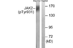 Immunohistochemistry analysis of paraffin-embedded human brain tissue using JAK2 (Phospho-Tyr931) antibody. (JAK2 anticorps  (pTyr931))