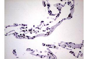 Image no. 5 for anti-Nibrin (NBN) (AA 183-460) antibody (ABIN1491066)