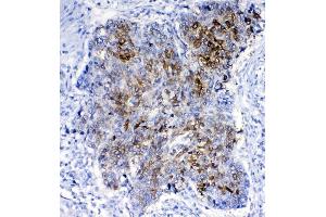 IHC analysis of GSTA1/A2/A3/A4/A5 using anti-GSTA1/A2/A3/A4/A5 antibody (ABIN5518995). (GSTA1 anticorps  (AA 2-222))