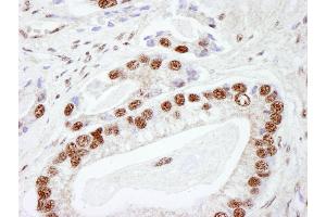 Immunohistochemistry (IHC) image for anti-Protein Kinase, DNA-Activated, Catalytic Polypeptide (PRKDC) (AA 2100-2150) antibody (ABIN7448533) (PRKDC anticorps  (AA 2100-2150))