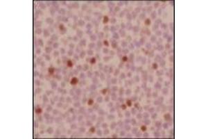 Immunohistochemistry (IHC) image for anti-Forkhead Box P3 (FOXP3) antibody (Biotin) (ABIN2853612)