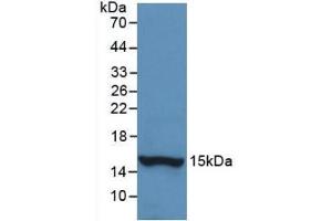 Detection of Recombinant HTN1,Human using Monoclonal Antibody to Histatin 1 (HTN1) (HTN1 anticorps  (AA 20-57))