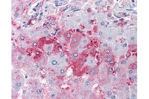 Immunohistochemical (Formalin/PFA-fixed paraffin-embedded sections) staining in human liver with DUSP26 polyclonal antibody . (DUSP26 anticorps)